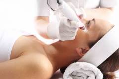 MicroneedlingFoto3-1-370x370-1